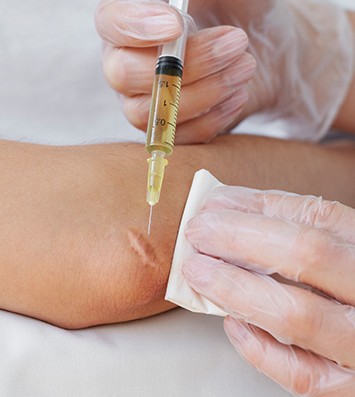 Inject Keloid/0,1 ml