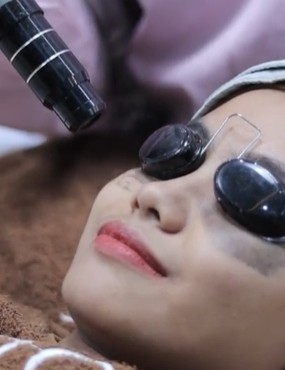 Laser Kantung Mata