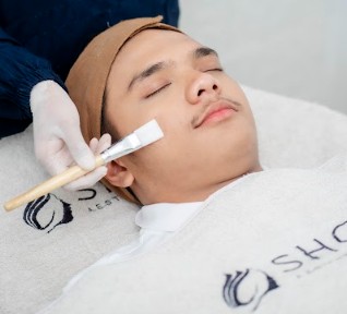 Peeling for Face Acne/Whitening