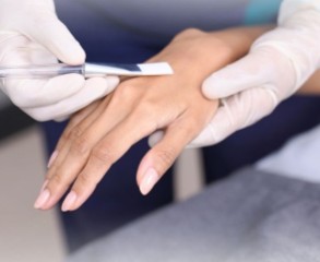 Chemical Peeling Body Area - Tangan