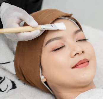 Facial Chemical peeling For Acne
