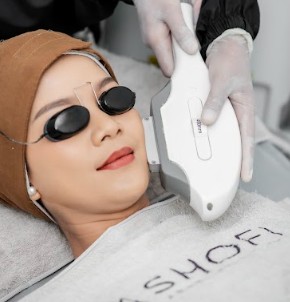 Facial IPL OPT/DPL for Face (Acne / Whitening)