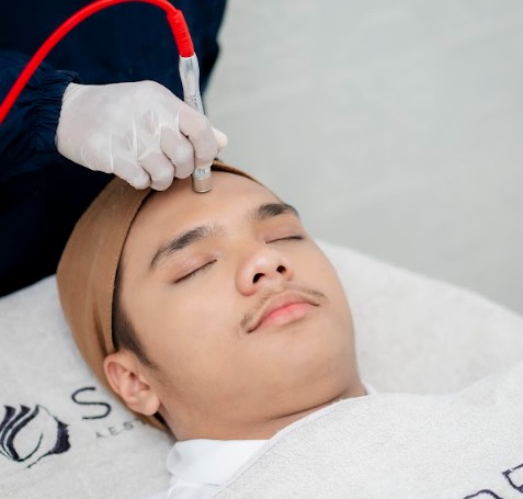 Microdermabrasi